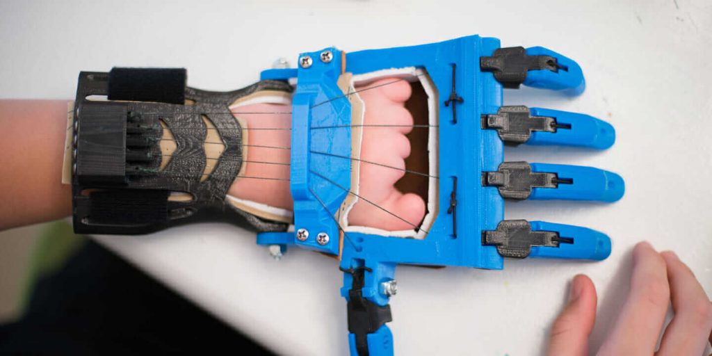 3d printed prosthetics is one of the Inspiring 3D Printing Projects